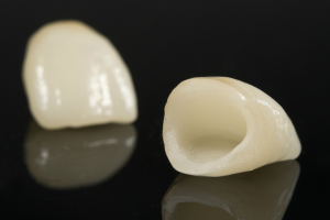 That's How Porcelain Crowns look like