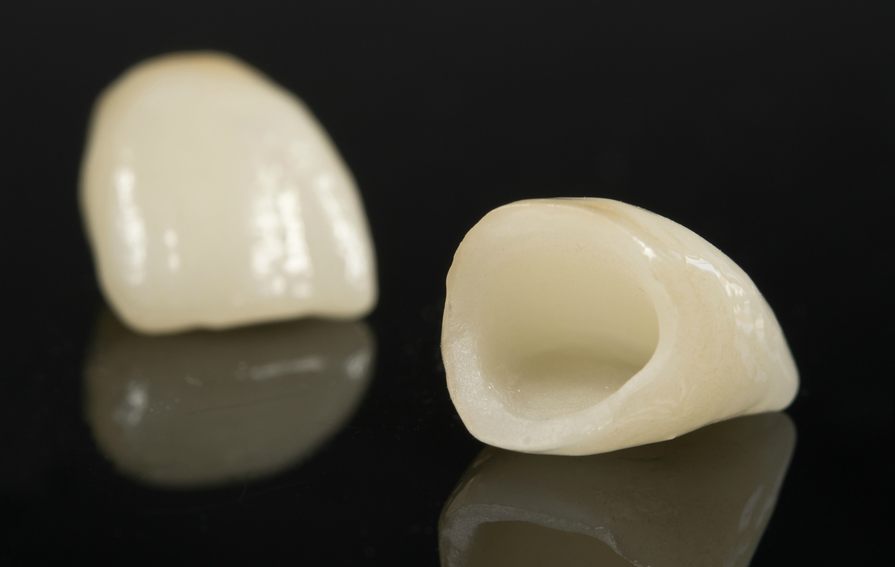 Full Porcelain Crowns and Bridges Gorbatov Dentistry Your Dentist