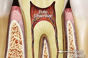 A Step-By-Step Guide To Root Canal Treatment