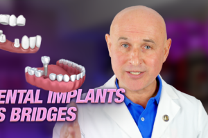 Implants vs. Bridge Work: Making the Best Choice for Your Dental Health