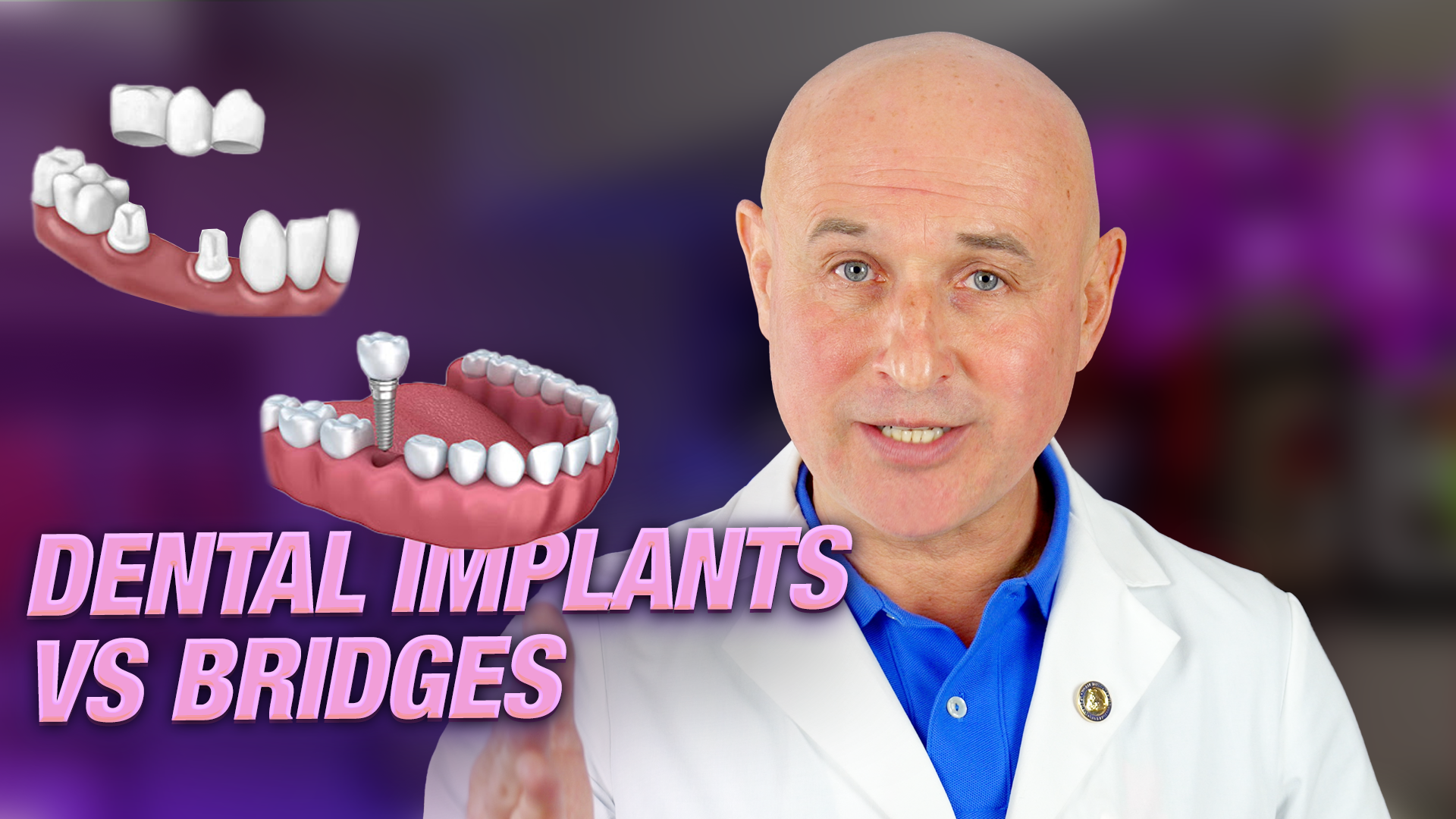 Implants Vs. Bridge Work: Making The Best Choice For Your Dental Health ...