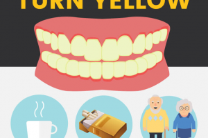 Why Do Teeth Turn Yellow?