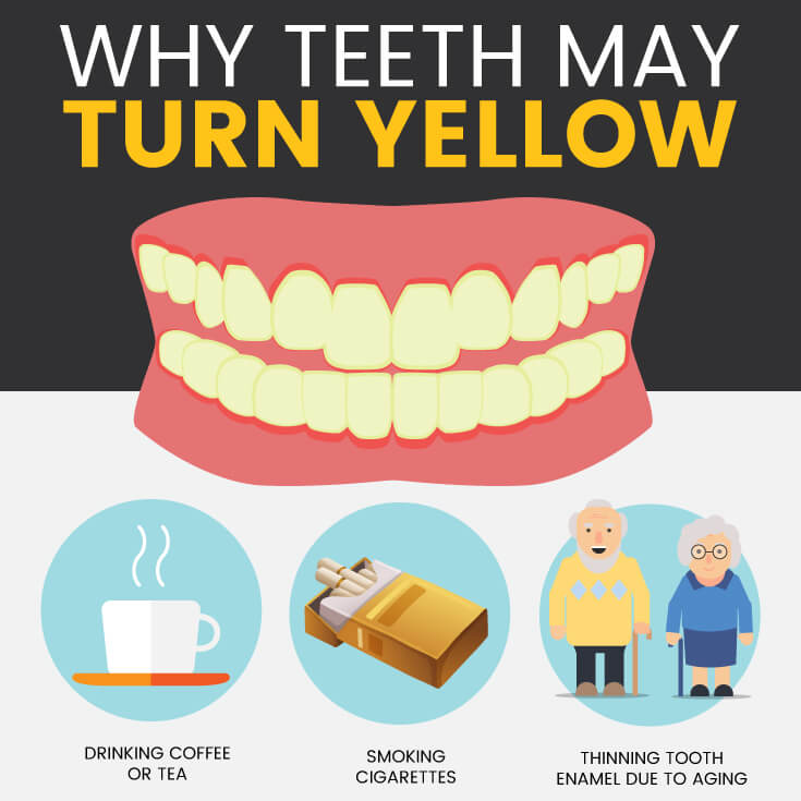 Yellow Teeth From Coffee