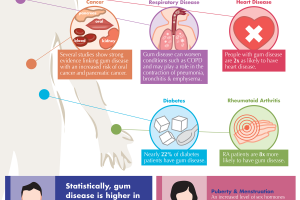 The Surprising Link Between Gum Disease and Systemic Disease