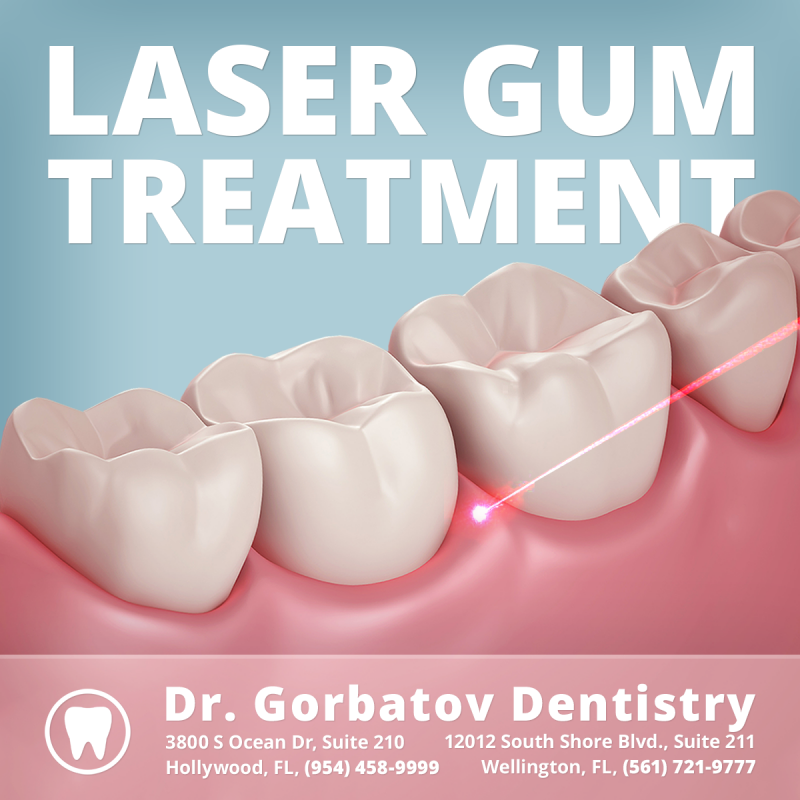 Laser Gum Treatment